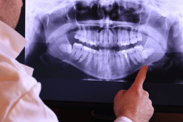 Best Broken Tooth Emergency  in Cashion, OK