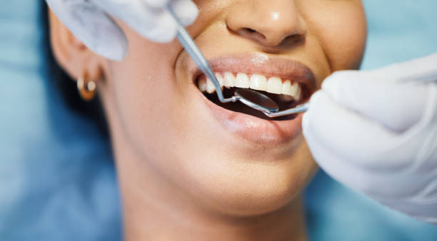 Best Emergency Dentist Near Me  in Cashion, OK